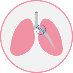 Asthma Can Make Breathing Harder